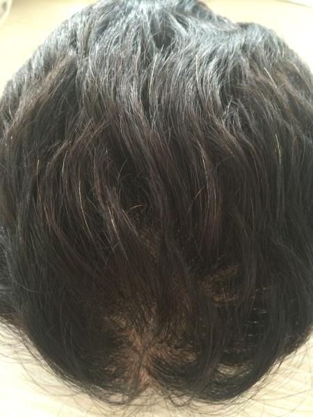 Npu Base 10*7 Perruque de cheveux pour hommes, densité moyenne, remplacement capillaire