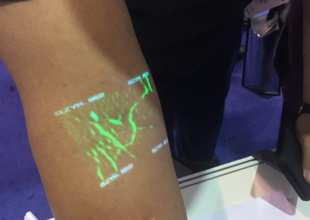 Vena de alta resolución de los pacientes obesos que localiza el infrarrojo del dispositivo para Venipuncture