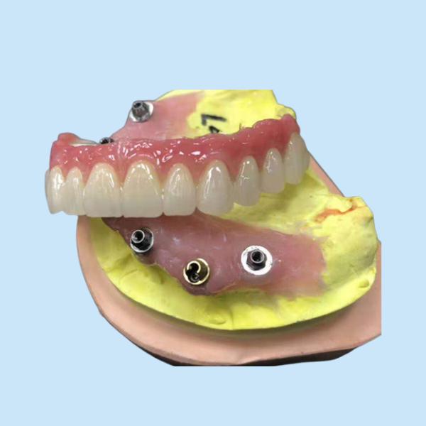 Имплантируйте крону Zirconia устоя зубоврачебную естественную совсем на 4 Dentures
