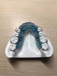 Adjustable Retainer Palate Expander Safe Comfortable Teeth Retention Solution