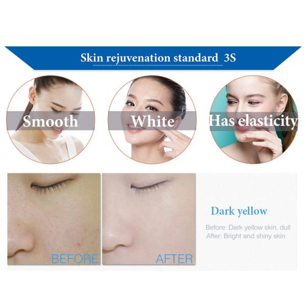 Jet Peel Deep Clean Facial Hydra Dermabrasion Machine for Skin Therapy