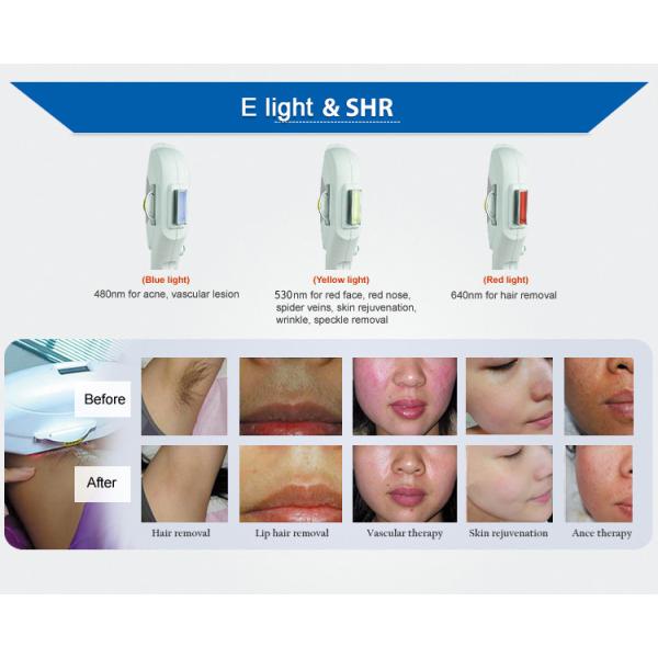 Máquina del retiro del pelo del laser del OPT del Nd Yag Rf IPL de Elight para el retiro vascular