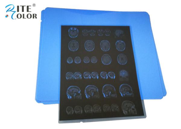 Resistência à água 8 * 10 polegadas PET azul baseado em Raios X filme médico para impressão de jato de tinta de imagem