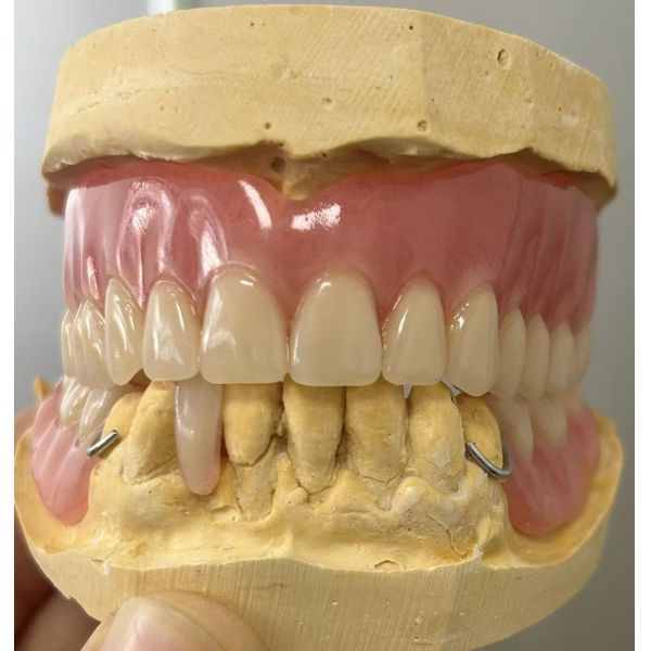 Full Arch Denture