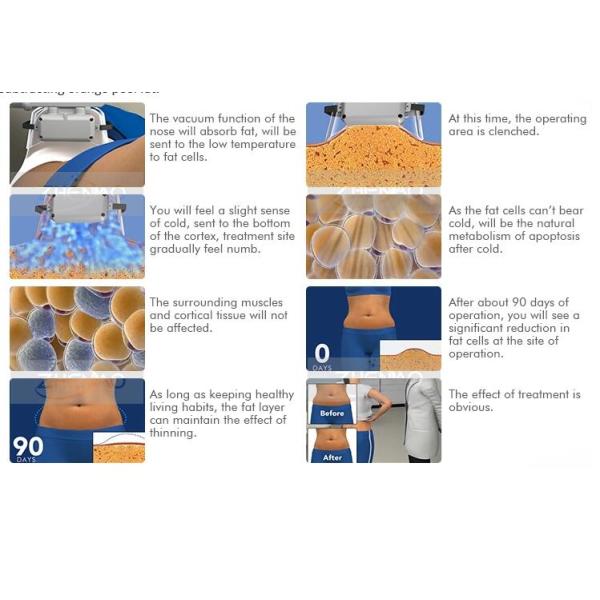 40KHZ Cavitation Body Slimming Machine For Fat Freeze Cryolipolysis Treatment