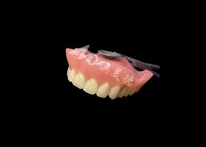 Full Acrylic Dentures With Suction Cups For Enhanced Stability And Confidence
