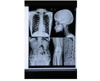 Blue Inkjet Medical X Ray Film Medical Dry Film A4 Sheet Or In Roll No Reviews Yet
