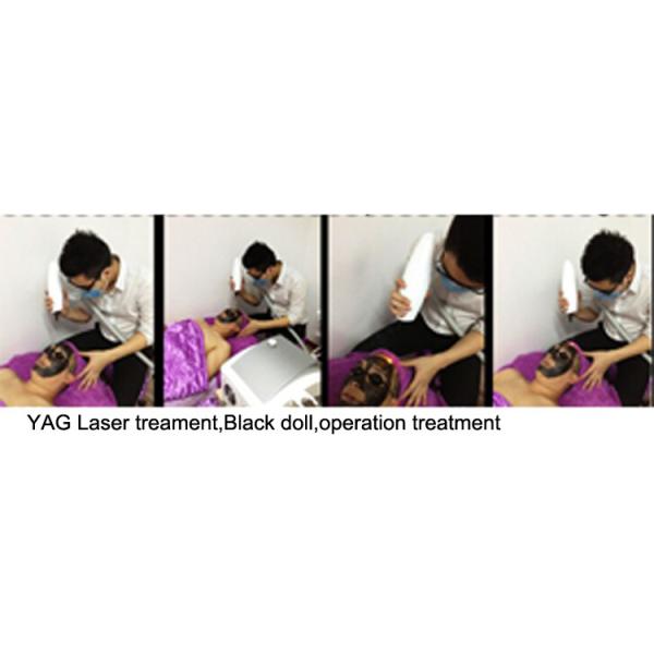 Машина для удаления татуировок Nd Yag Q Switched Laser Device