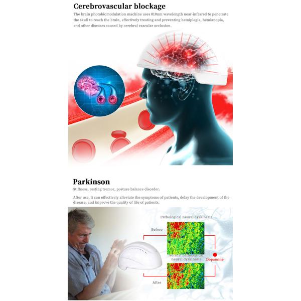машина Biohackers Photobiomodulation стимулированием 810 nm LightBrain