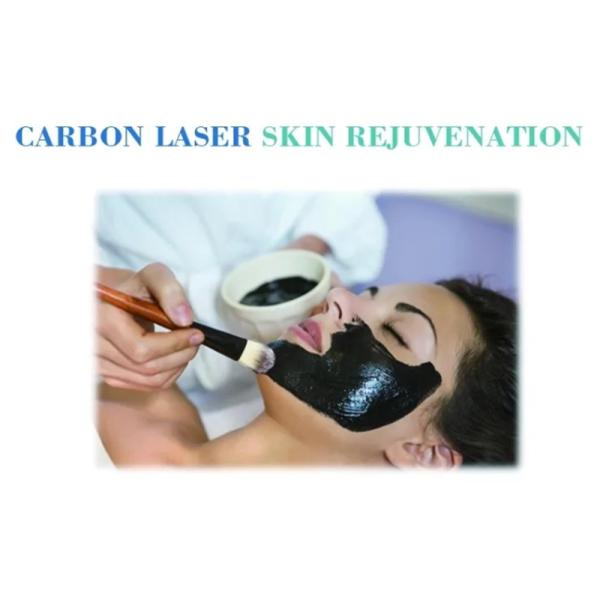 Прибор удаления пигмента удаления татуировки лазера Nd Yag случая большой силы небольшой