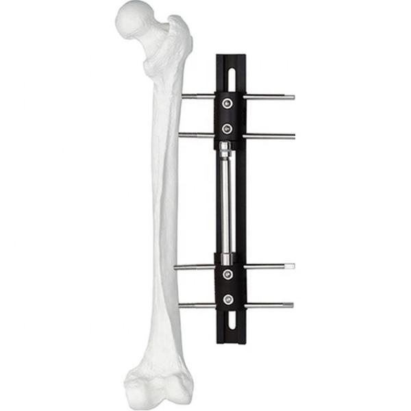 Membro pediatra do orthofix do sistema de LRS que alonga Fixator externo