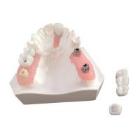 Boa barra inter biológica do implante dental da miscibilidade com aprovação de FDA