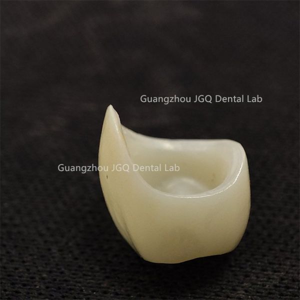 All Ceramic Crown Bridge Dental Laboratory Natural Looking With Aesthetic Effect