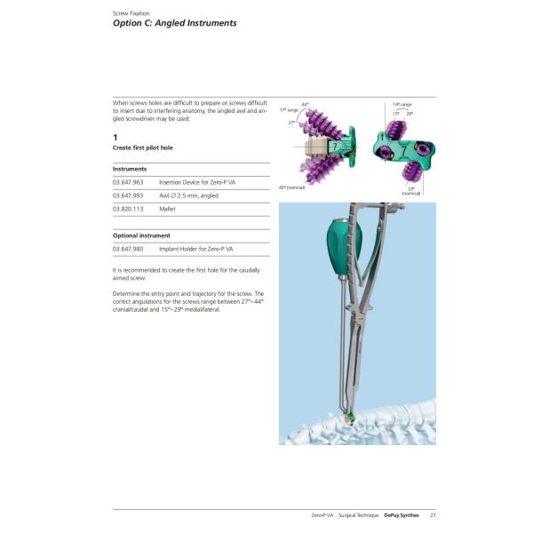 Sterilization 2 Screws Zero Profile Cage Anterior Cervical Cage Stand Alone CE Spinal Surgery