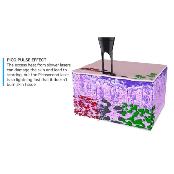 Multifunctional Picosecond Hollywood Diamond Carbon Peeling Sking Rejuvenation