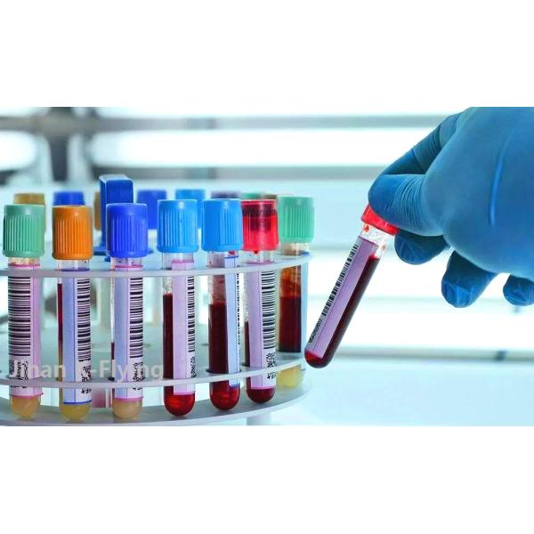 PET 1ml - 10ml Medical Consumable Products Blood Collection Tube No Additive