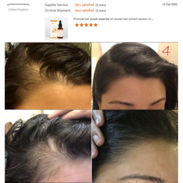 Nutrient Solution 30ml Hair Regrowth Serum Oil Customized Private Label