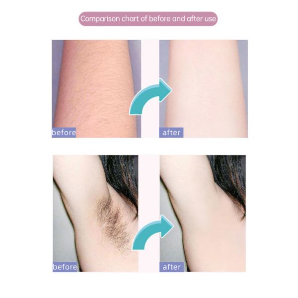 100 Sheets/bag 7*20 cm Waxing Paper Strips for Body Hair Removal Using