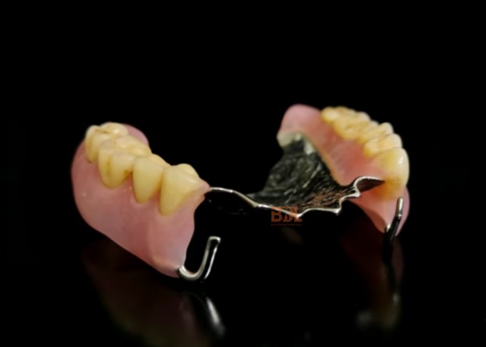 Biocompatible Metal Framework Partial Dentures manufactured to meet stringent dental industry standards and patient safety