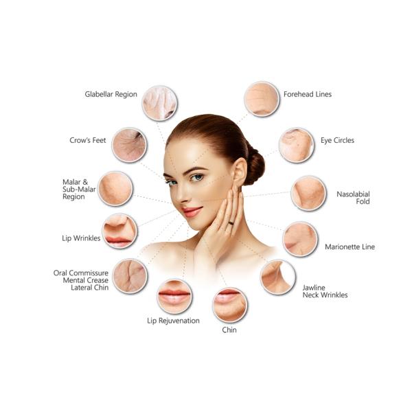 Перекрёстное связывание NeckNeuramis Dermal Filler Deep Hyaluronic Acid Face Ect Lip Nose