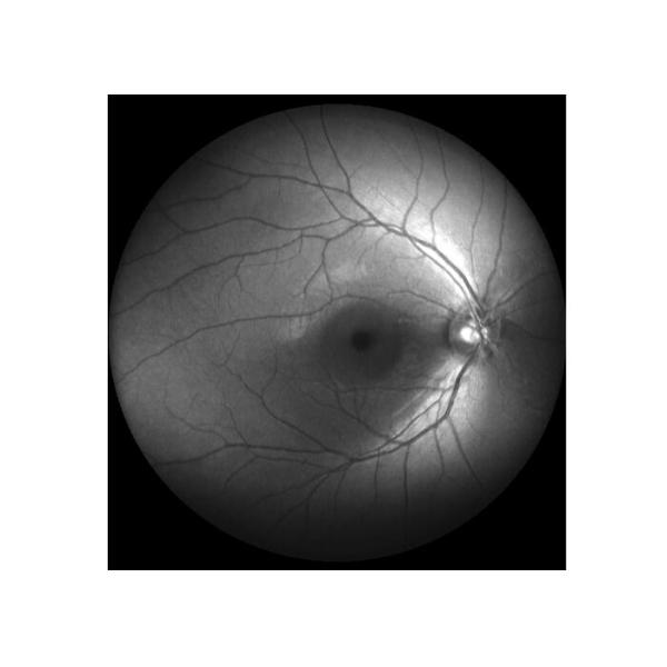 Equipo oftálmico de Angiograph Digital 160° de la retina