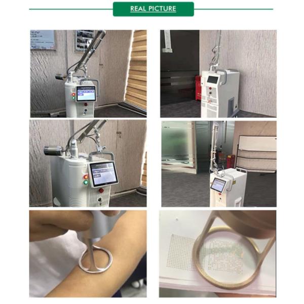 Подмолаживание кожи машины 10600nm лазера СО2 удаления пигмента частичное