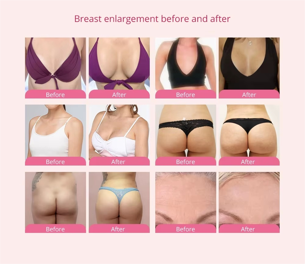 Breast Care Vacuum Sucking Dual Handheld Massager Portable Design