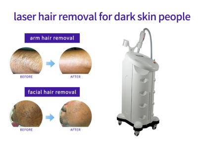 Solid State Laser Hair And Tattoo Removal Machine , Industrial Laser Hair Removal Machine