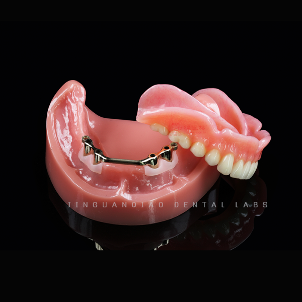 China Lab Permanent Restoration Complete Composite Acrylic Dentures Tooth CE FDA
