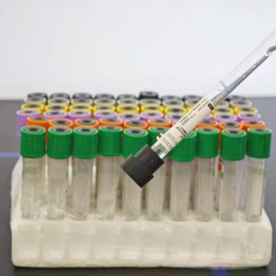Sodium Citrate ESR Blood Collection Tube with Screw Cap