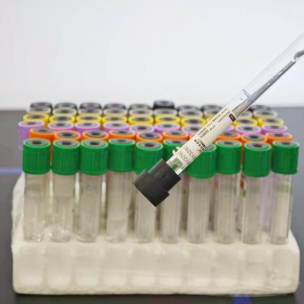 Sodium Citrate ESR Blood Collection Tube with Screw Cap