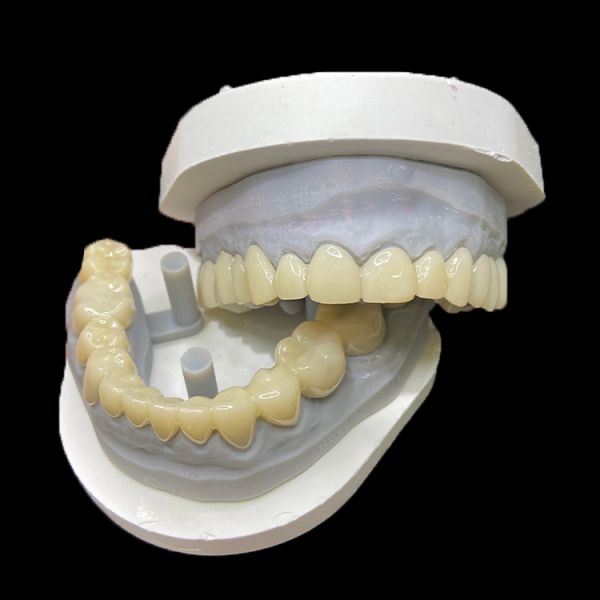 PMMA Temporary Restorations CAD/CAM PMMA Crowns and Bridges for Provisional Dental Cases