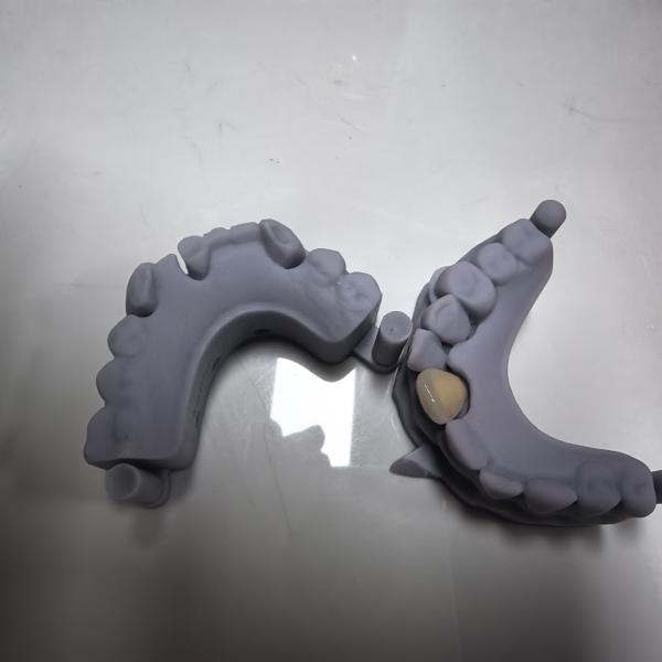 High Cost Effectiveness​ 3D Dental Model Accurate Anatomy Fast Turnaround