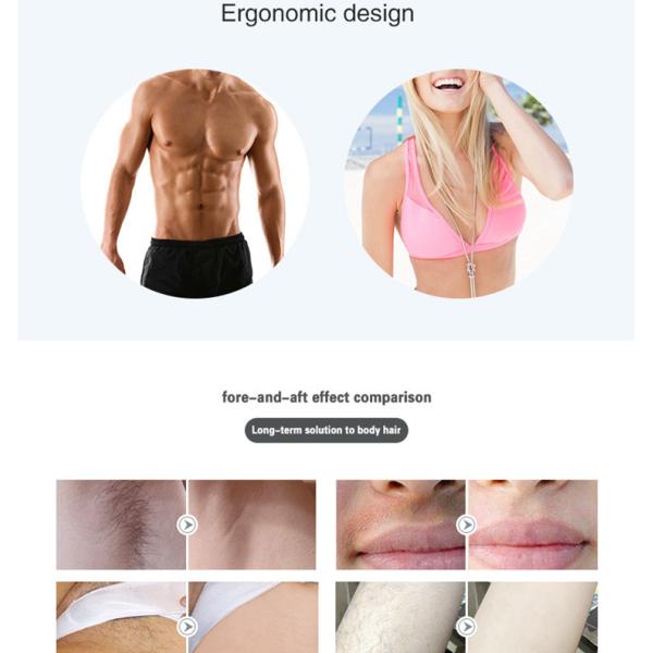 Portable Home Laser Hair Removal Machine With 100000 Pulse Tender Skin