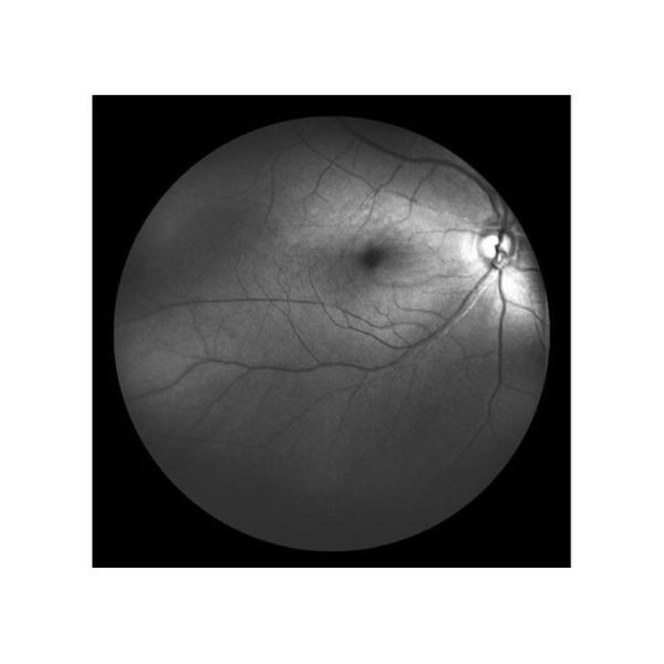 Оборудование камеры Fundus сканирования лазера профессиональное офтальмическое с Fundus отображая размер зрачка FOV 160° минимальный 2 mm