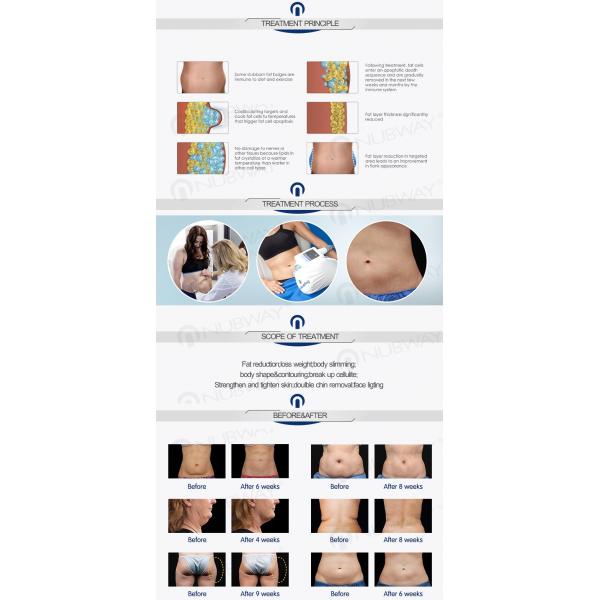 Advanced technology electronic cooling slim freezer weight loss cryolipolysis cryo machine