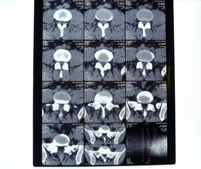 Filme seco médico branco do ANIMAL DE ESTIMAÇÃO AGFA