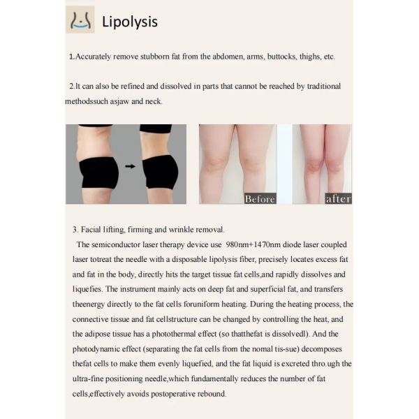 Fat Lipolysis Laser Machine Face Lifting Liposuction 1470nm 980nm Diode Laser Gynecology