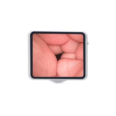 Endoscope flexible TUYOU avec écran de 3,5 pouces, réutilisable pour la bronchoscopie en fibre optique et la santé des animaux de compagnie