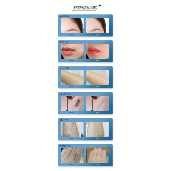 УПРАВЛЕНИЕ ПО САНИТАРНОМУ НАДЗОРУ ЗА КАЧЕСТВОМ ПИЩЕВЫХ ПРОДУКТОВ И МЕДИКАМЕНТОВ 1800W одобрило машину 2in1 Pico удаления волос лазера 808 диодов