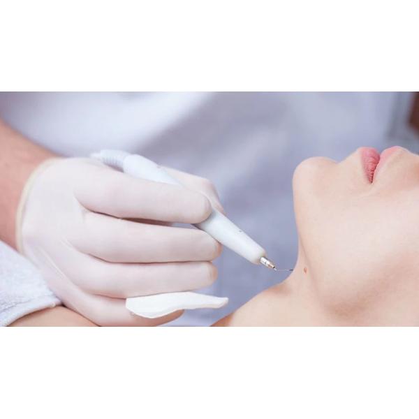 Веснушки татуируют ручку плазмы красоты моли точки удаления