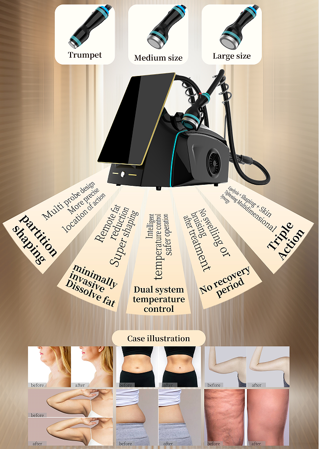 3 in1 Coldwave Shaping Device Face Lifting Body Contouring Skin Analysis Device