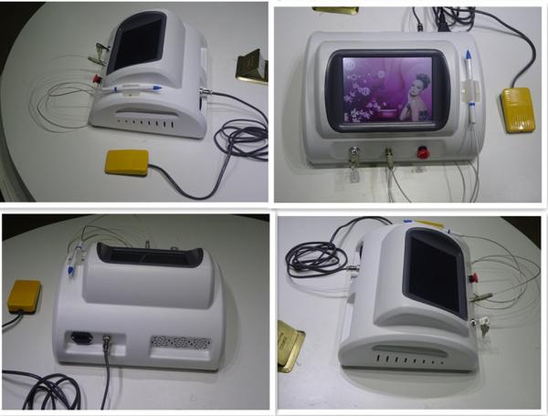 Painfree vacular spider vein removal high frequency machine on sale
