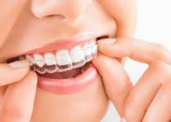 Clear PETG Sheet Beautiful Teeth Aligners PETG Sheet Manufacturers