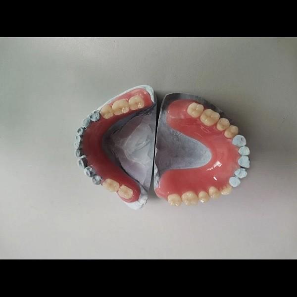 Removable Lower Upper Partial Acrylic Denture For Missing Teeth