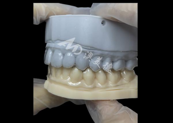 Appareils orthodontiques esthétiques Retenant invisible Correction simple et polyvalente