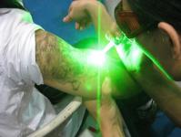 Laser 1064nm del Nd Yag de picolaser del neodimio de la dermatología portátil