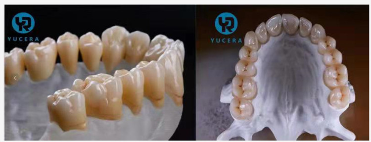 Venta Caliente Bloque de Zirconia Multicapa Presombreado 4D Cerámica Dental Cad Cam Laboratorio Dental para Media Boca