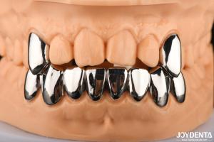 Dental Abrasive Resistant Crown Full Metal , Metallic FMC For Oral Rehabilitatio
