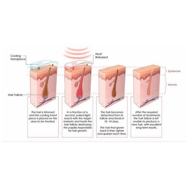 Portable IPL SHR Laser Hair Removal Machine One Handle Type For Beauty Salon